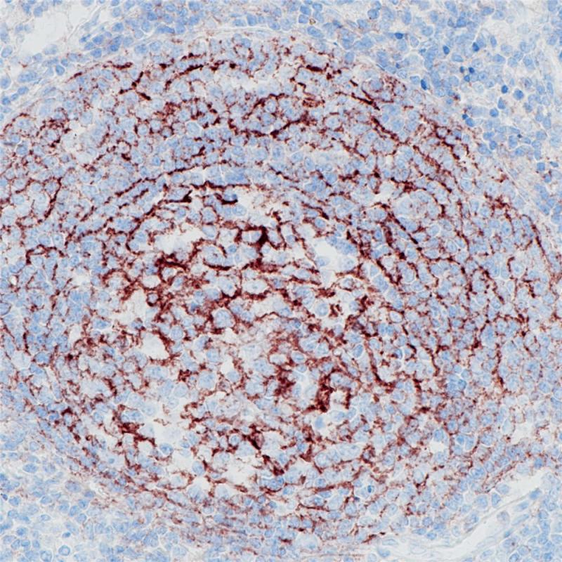 扁桃体 CD35 (BP6069) 染色
