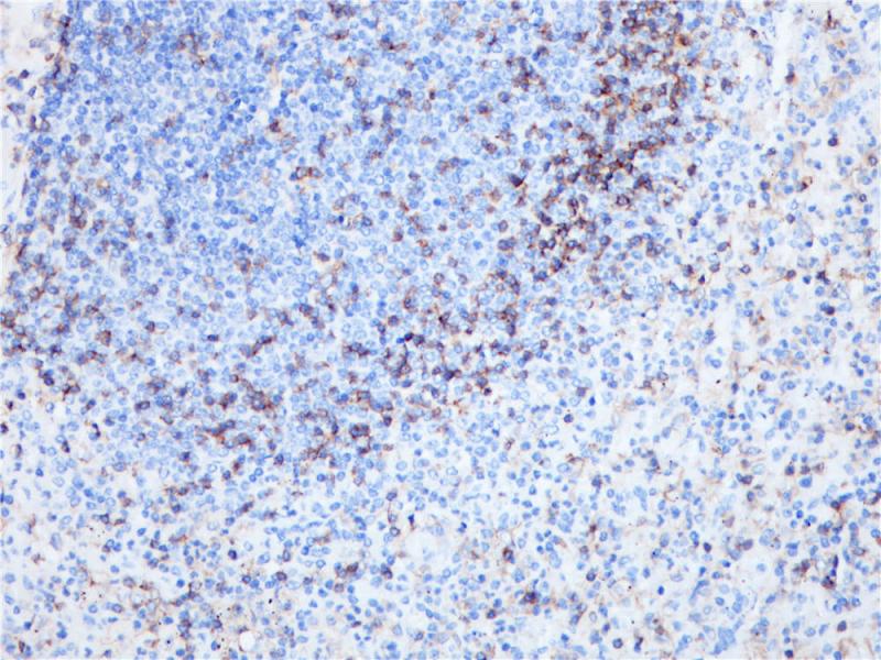 胰腺 CD4 (BP6028) 染色