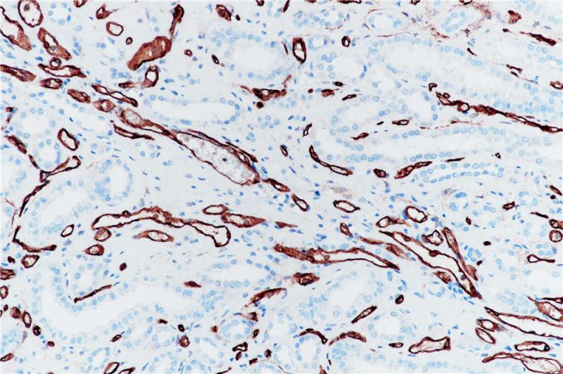 肾脏 CD34 (BP6047) 染色