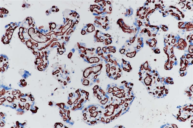 胎盘 CD34 (BP6047) 染色