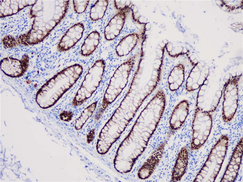 结肠 CDX2 (BP6023) 染色