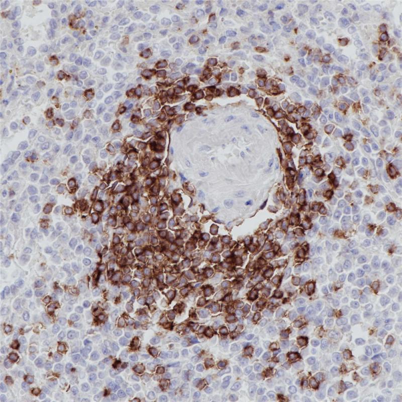 脾 CD5 (BP6090) 染色
