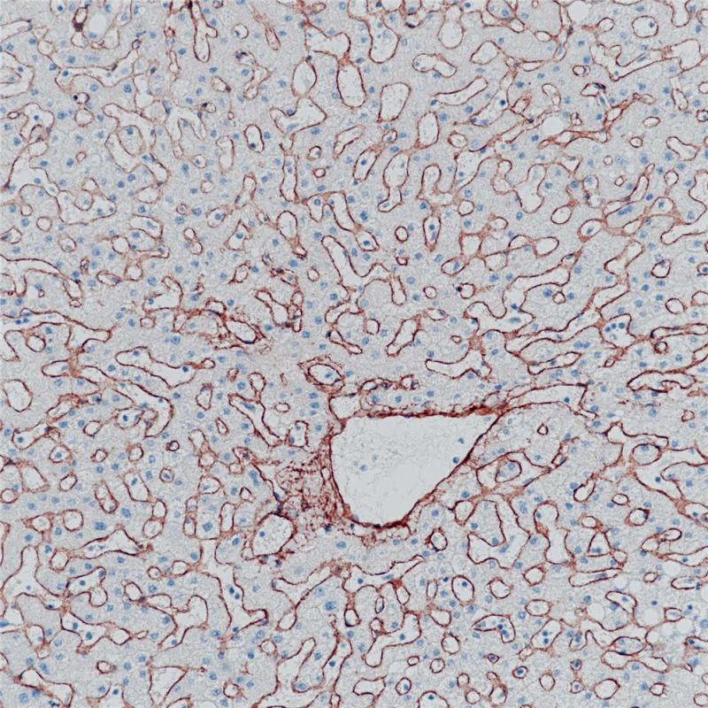 肝 Collagen Type IV (BP6072) 染色