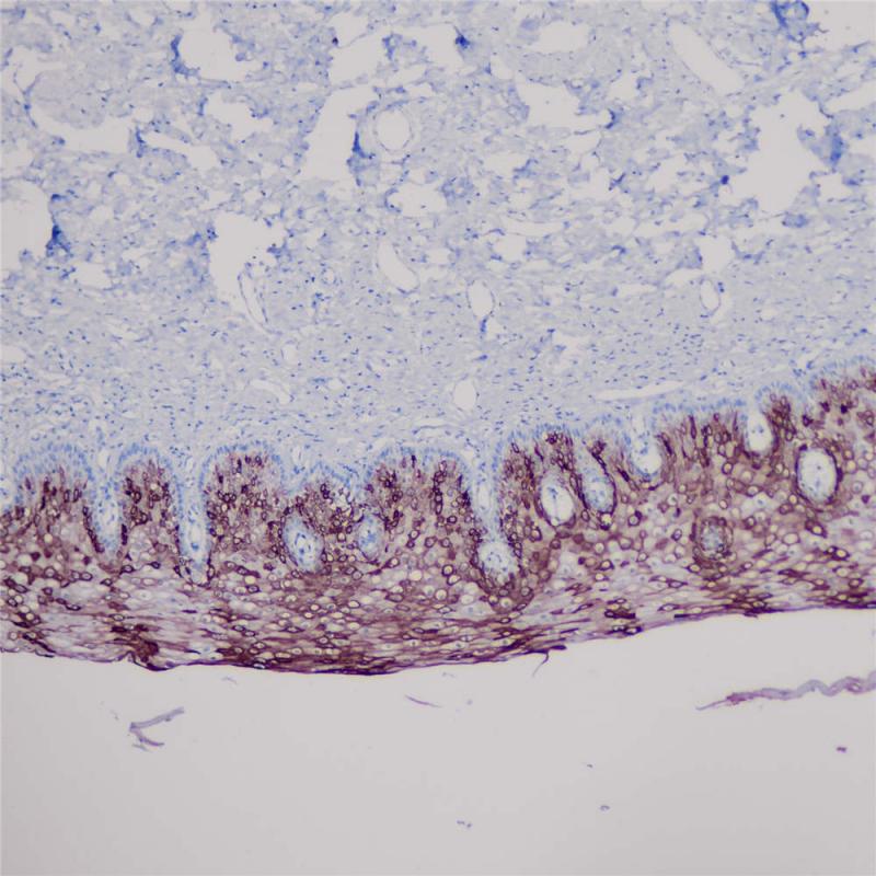 子宫 CK10 (BP6057) 染色