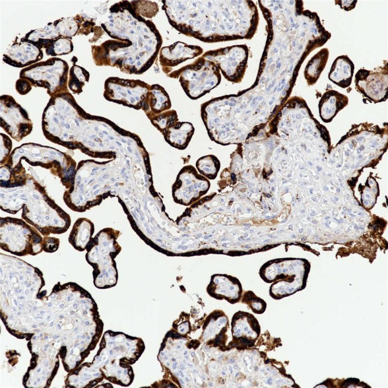 胎盘 HPL (BP6114) 染色
