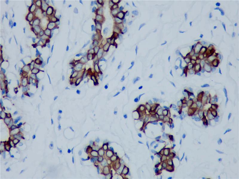 乳腺 CK8 (BP6005) 染色