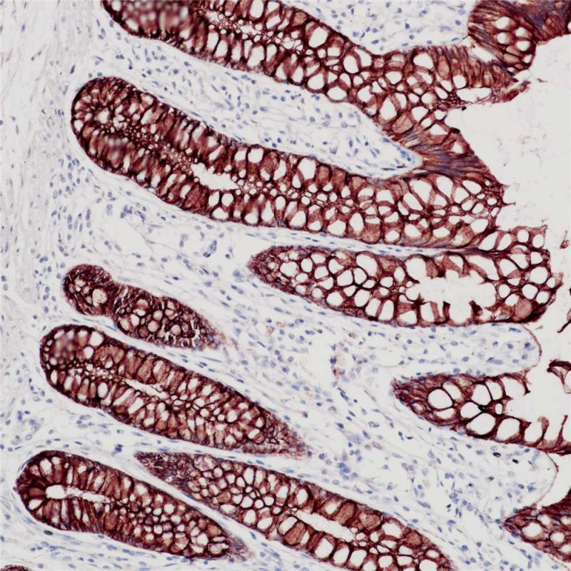 结肠 p120 (BP6075) 染色