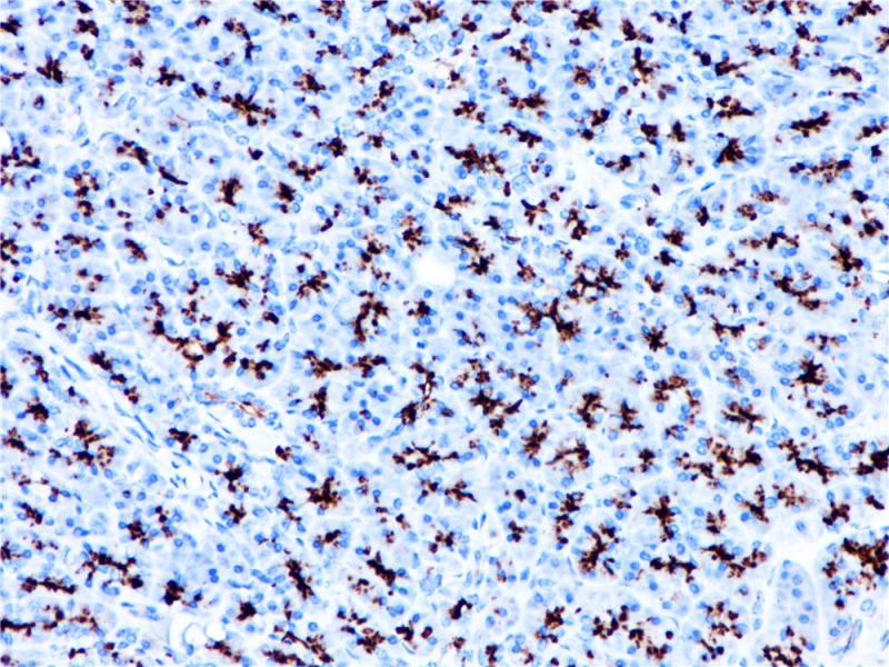 胰腺 MUC1 (BP6034) 染色