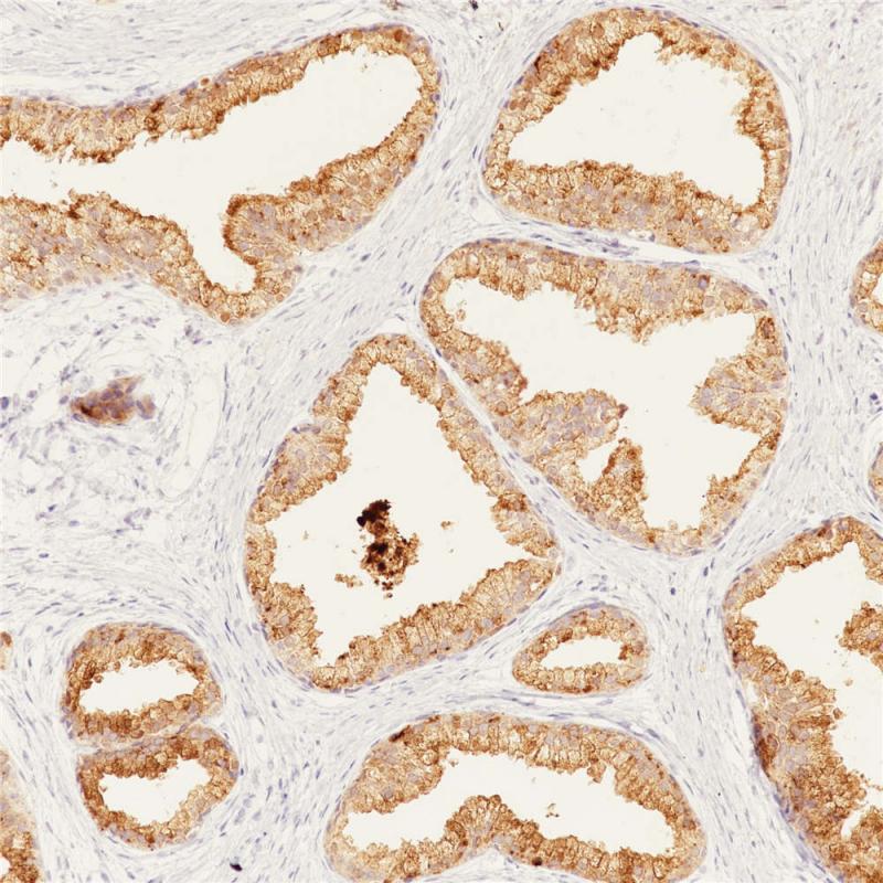 前列腺PSA(BP6043)染色