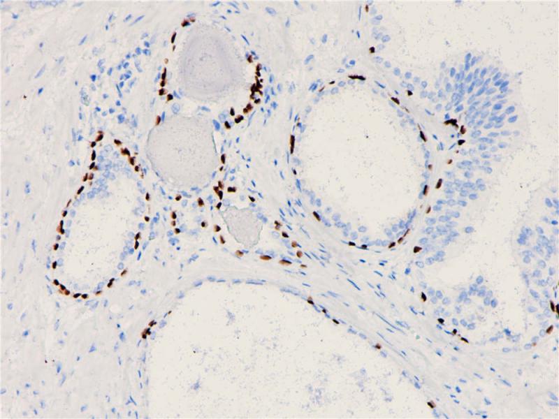 前列腺 p40 (BP6033) 染色