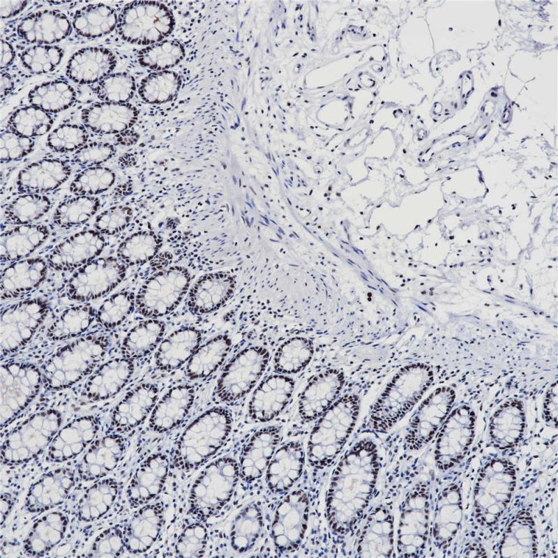 结肠 PMS2 (BP6116) 染色