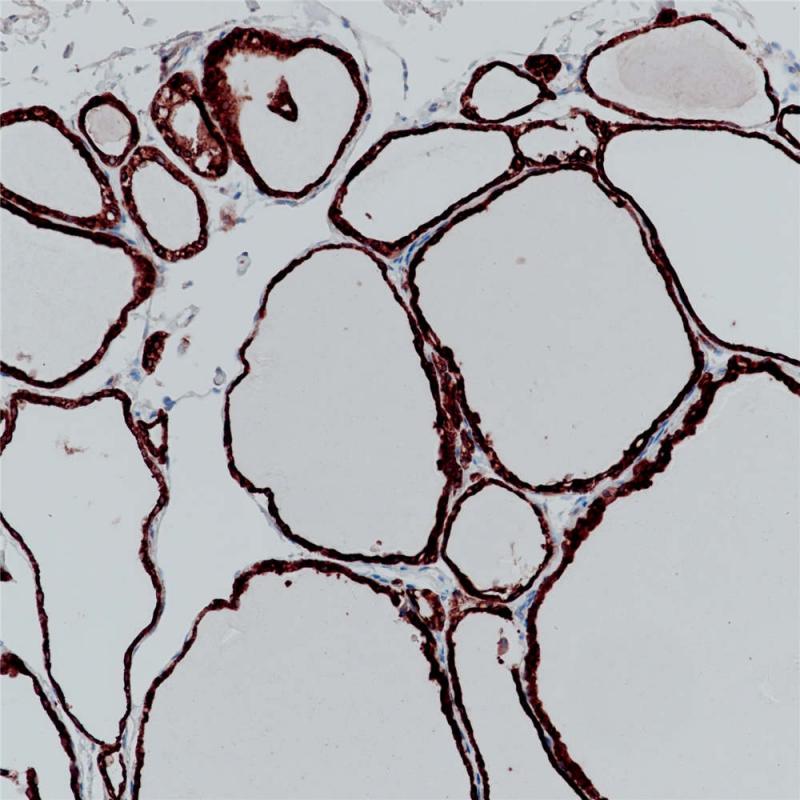 甲状腺 TPO (BP6071) 染色