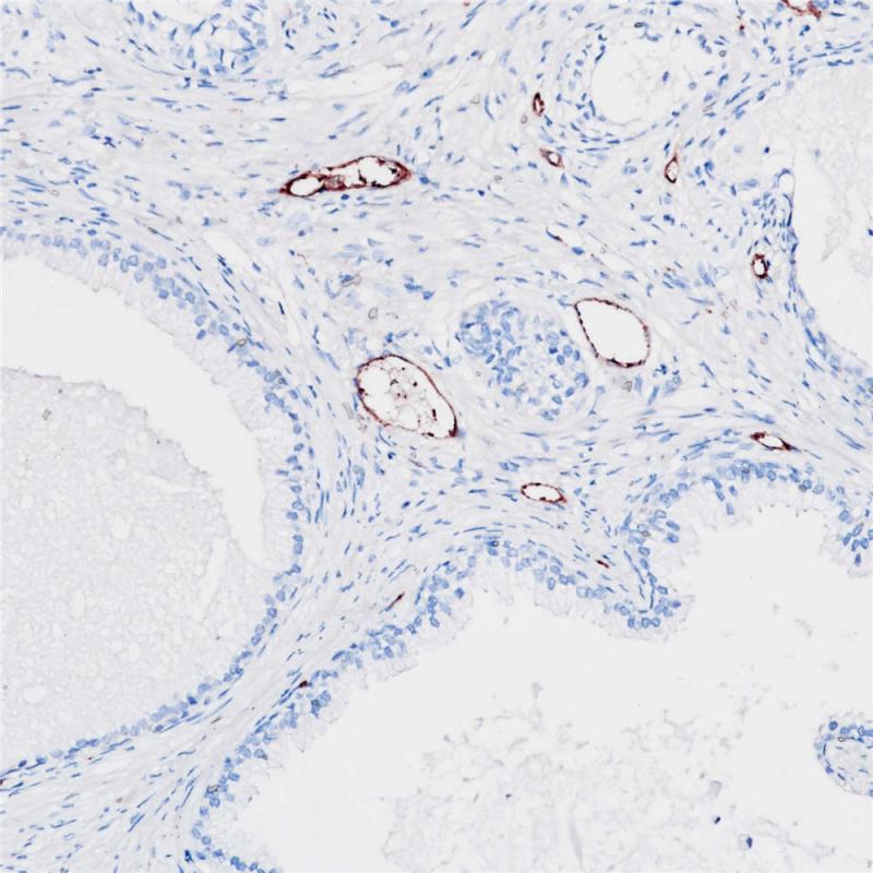 前列腺 VWF (BP6084) 染色