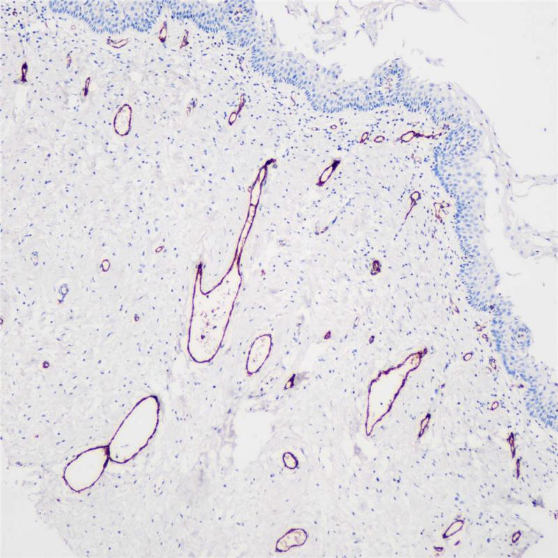 宫颈 VWF (BP6084) 染色