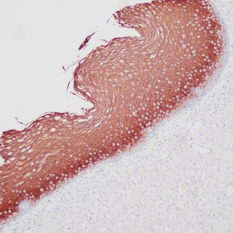 宫颈 CK1 (BP6077) 染色