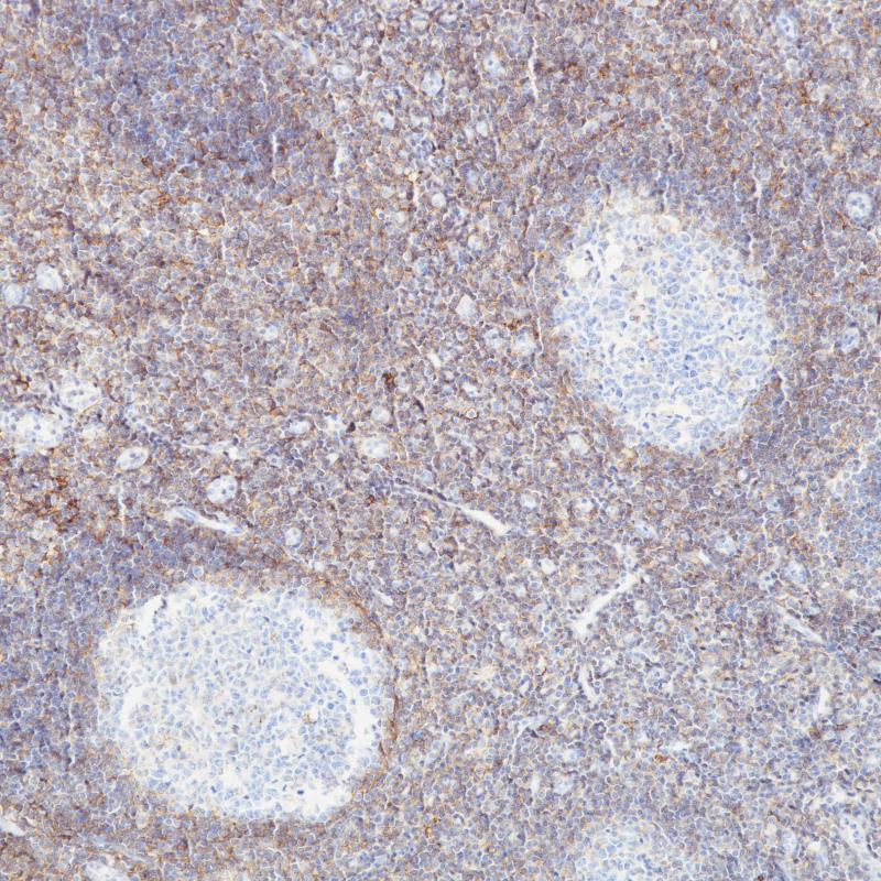 扁桃体 CD44 (BP6131) 染色