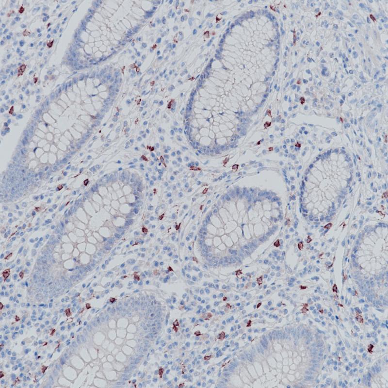 阑尾 CD117 (BP6064) 染色