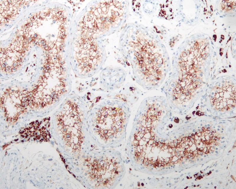 睾丸 ACE2 (BP6153) 染色