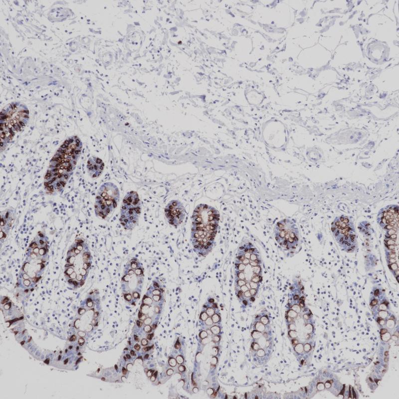 结肠 MUC2 (CCP58）染色