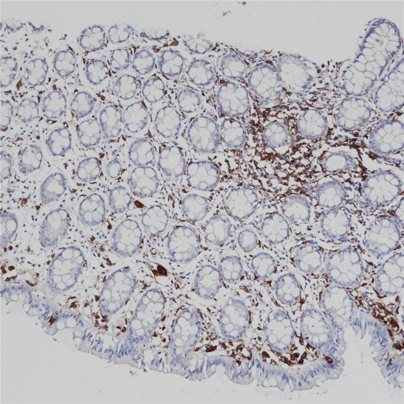 结肠MHC II(DRα)（BP6170)染色.jpg