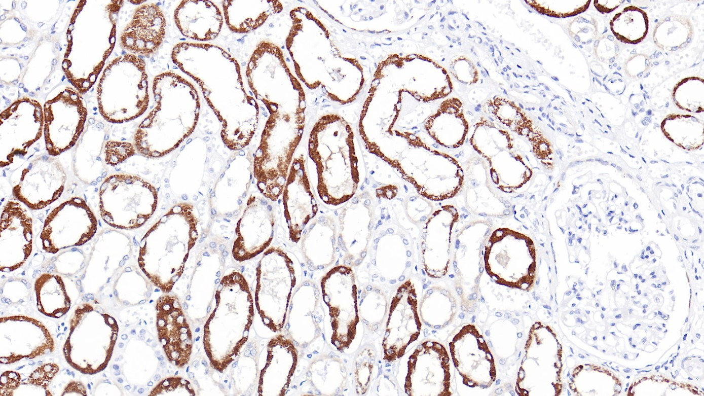 肾AMACR(CMA158)染色