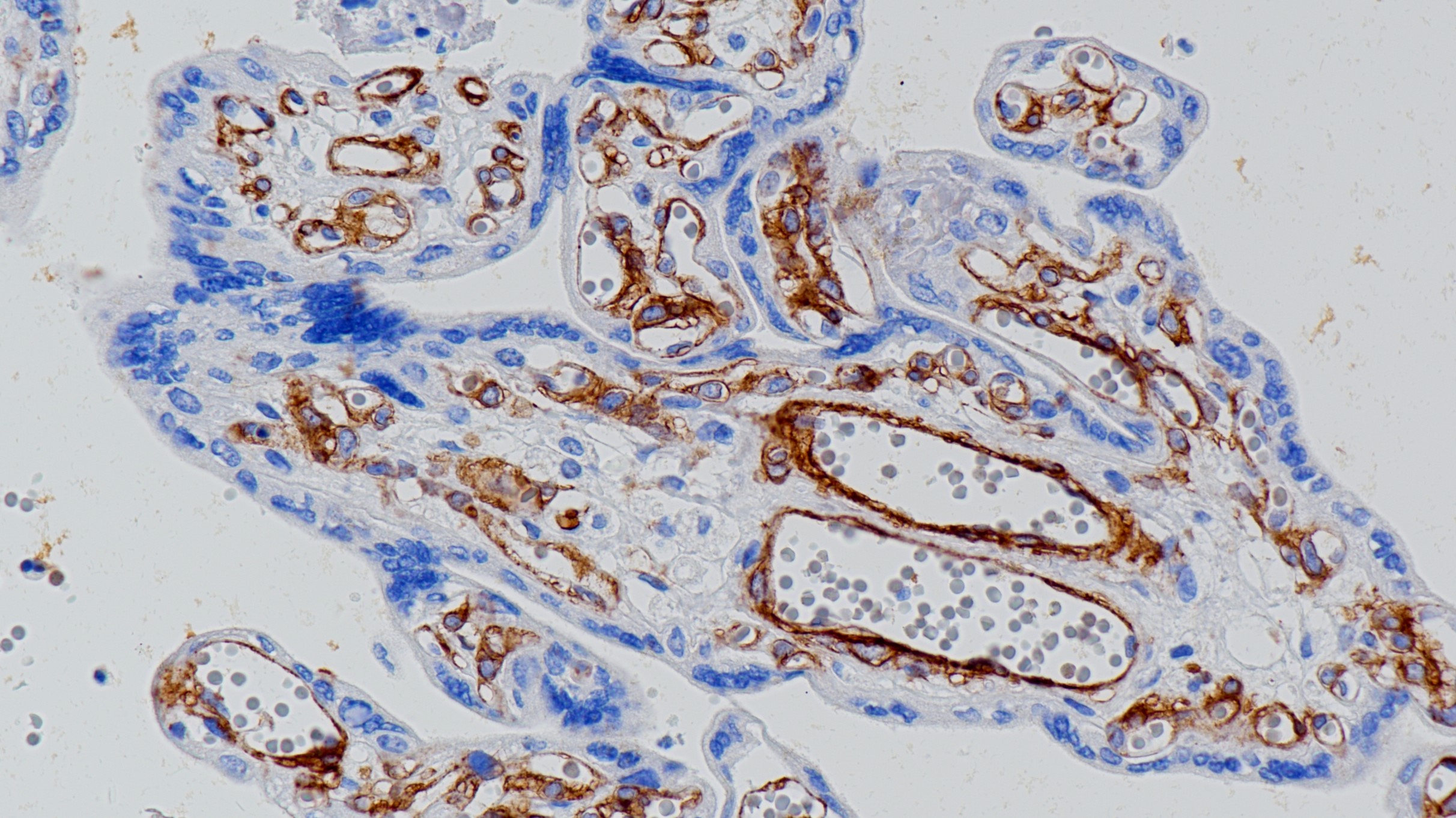 胎盘CD146(BP6162)染色