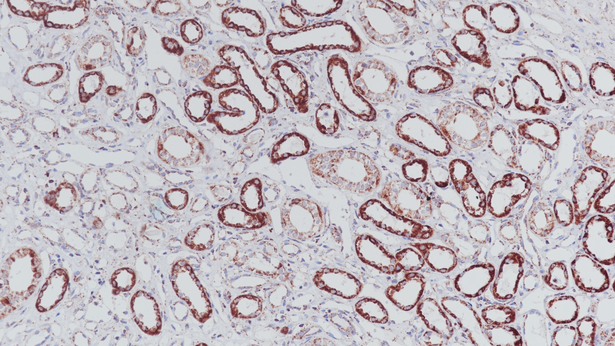 肾SDHB(BP6160)染色