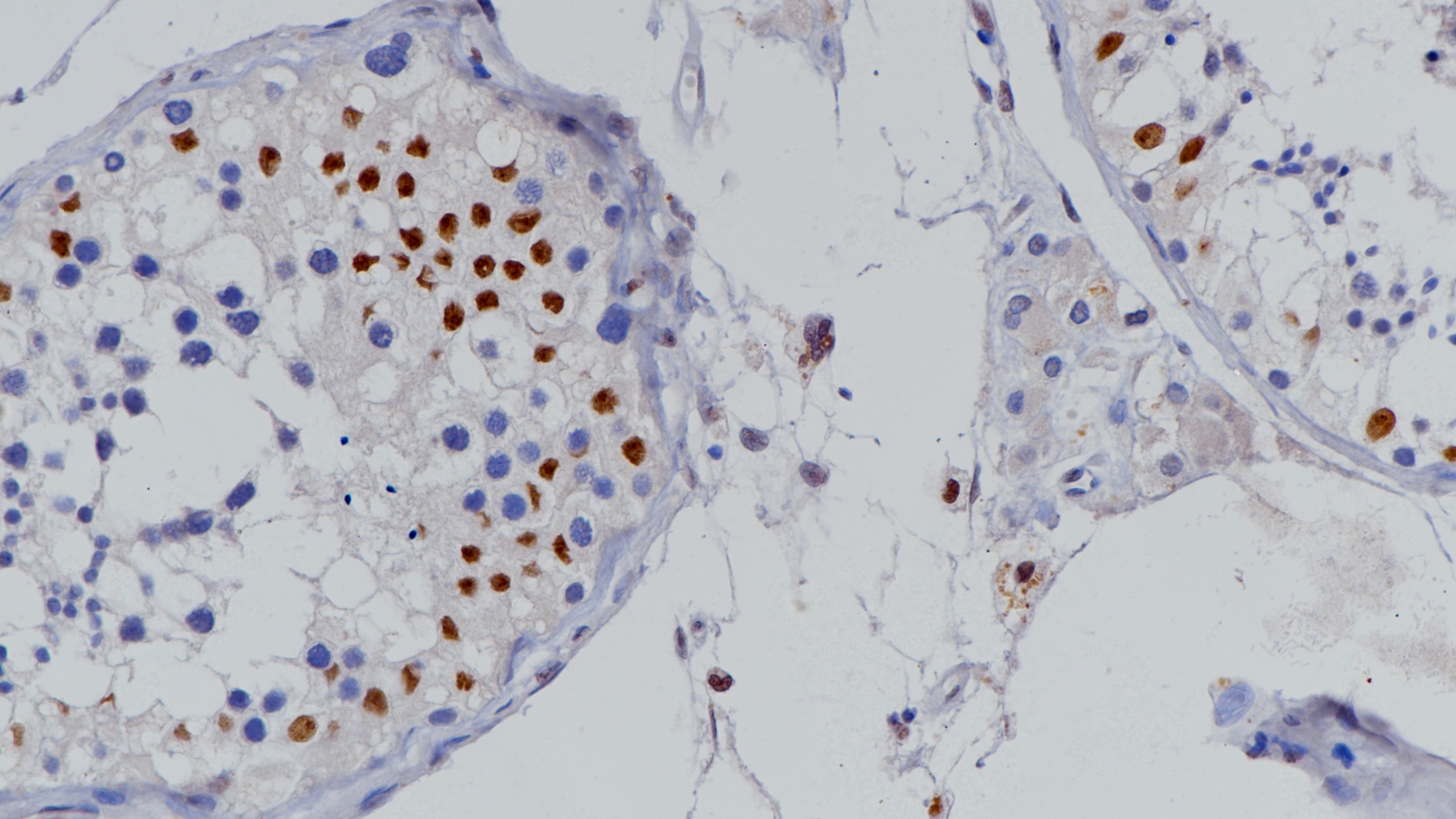睾丸n-Myc(BP6155)染色