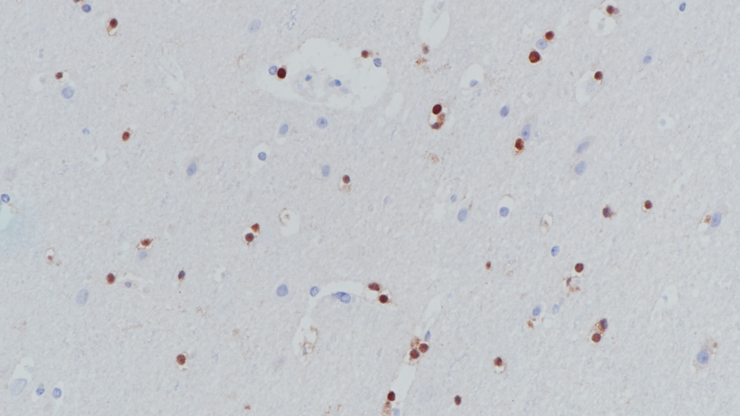 脑Oligo-2(BP6167)染色