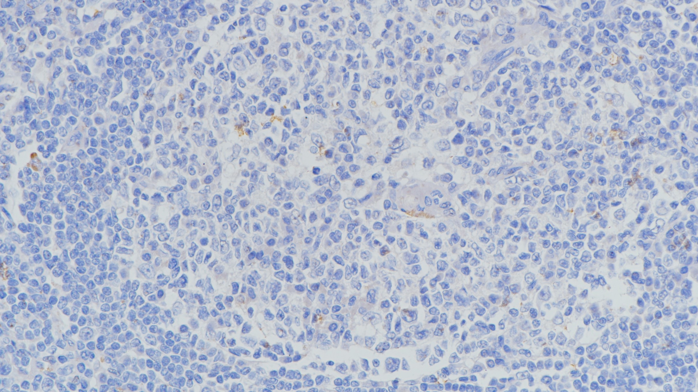 H3K27M (RM192) 扁桃体  阴性组织染色