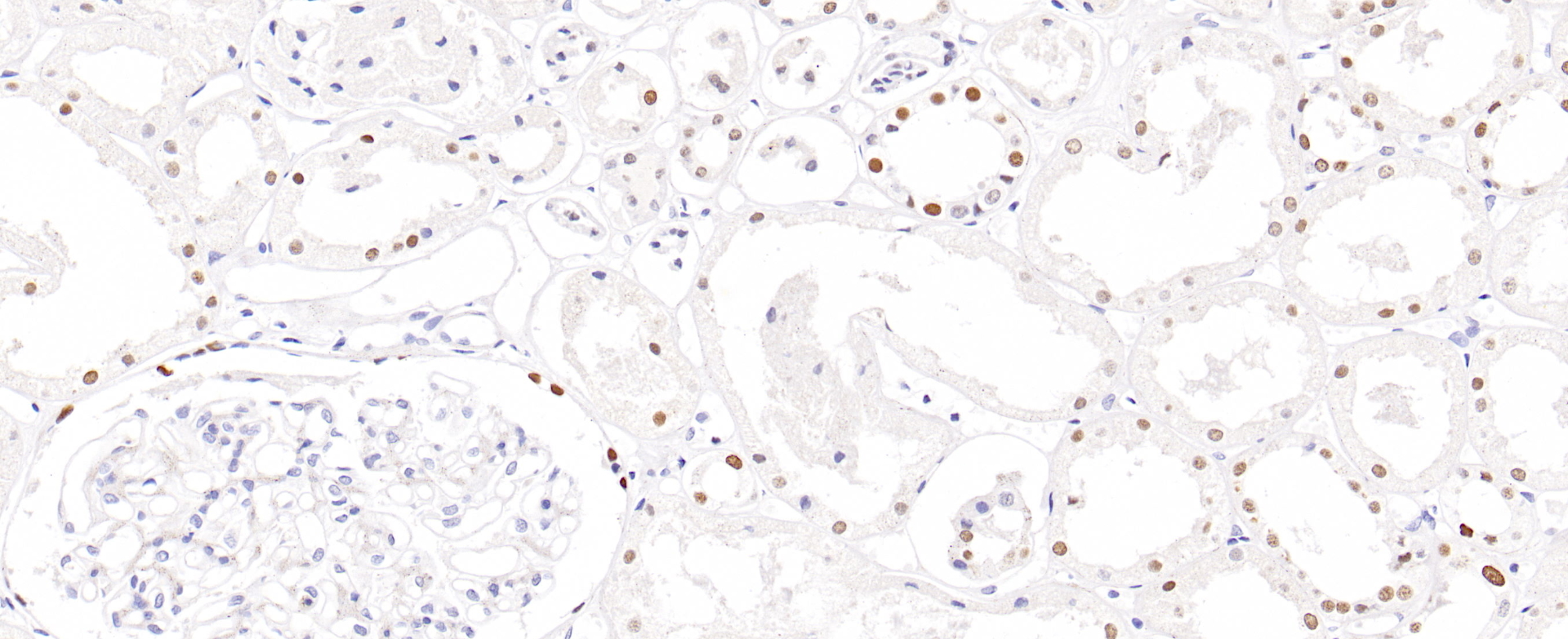 肾HNF1-Beta(EPR18644-13)染色