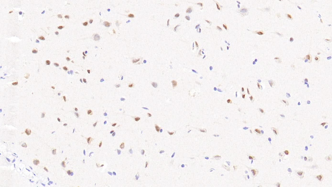 脑FOXG1(EPR18987)染色