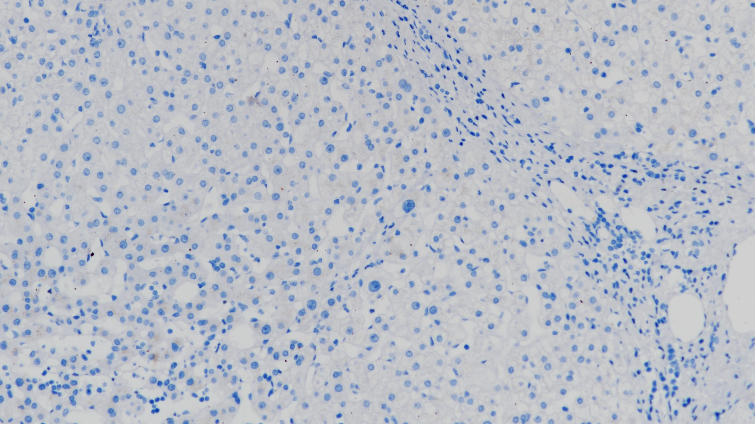 INA(2E3)肝 阴性组织染色
