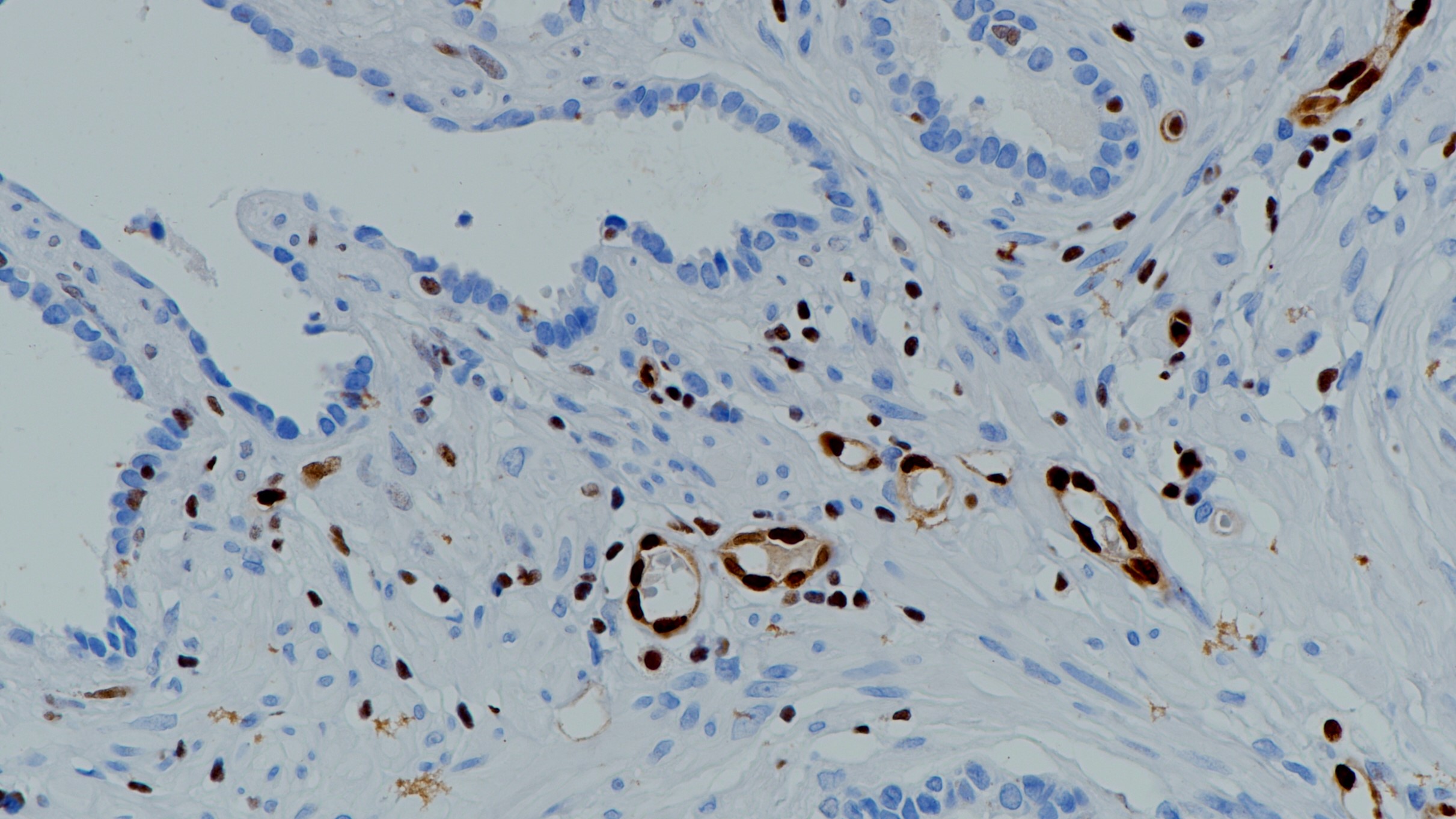 前列腺ERG(BP6127)染色