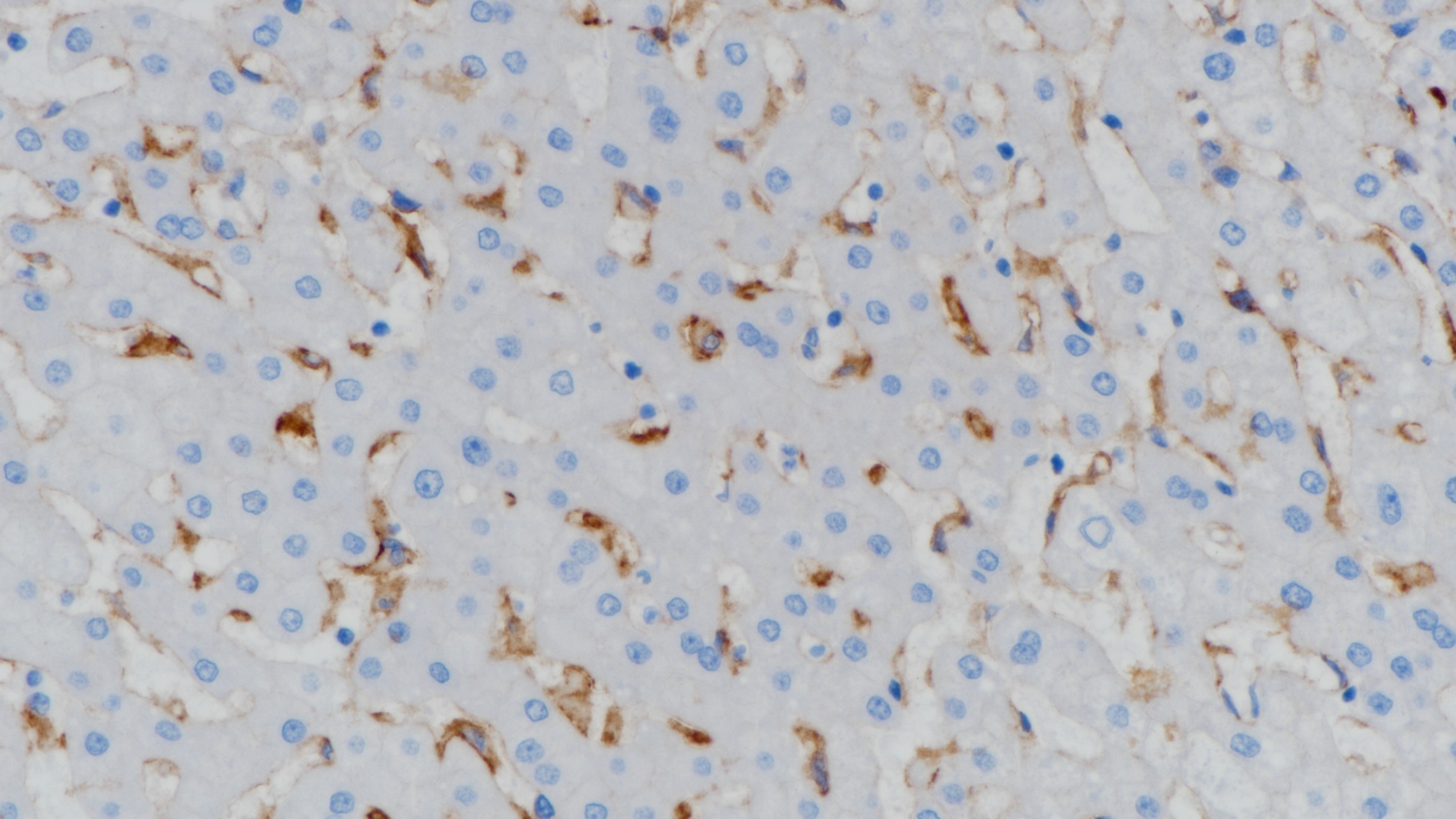 肝CD14(BP6111)染色