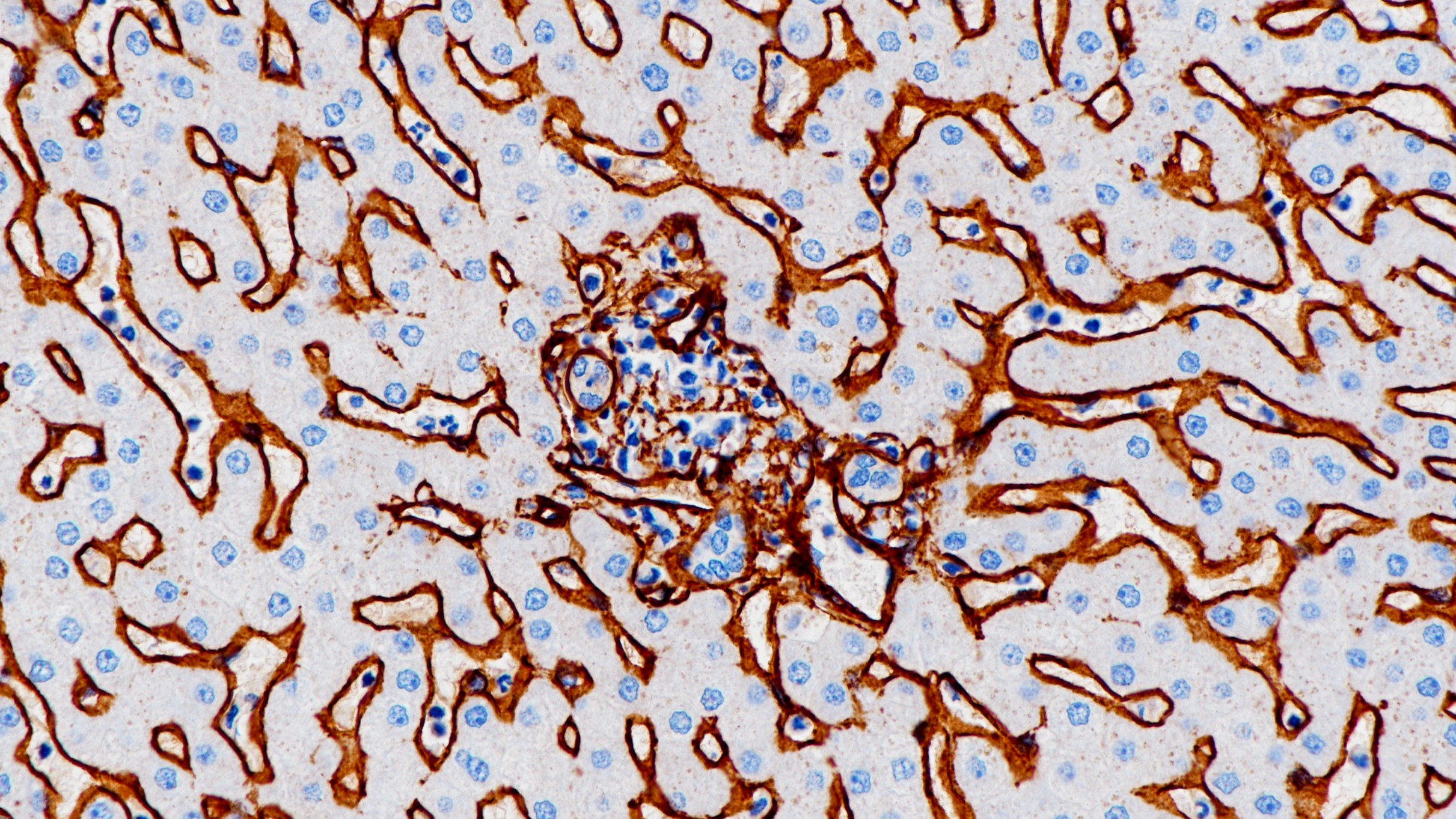肝Collagen Type Ⅳ (BP6072)染色