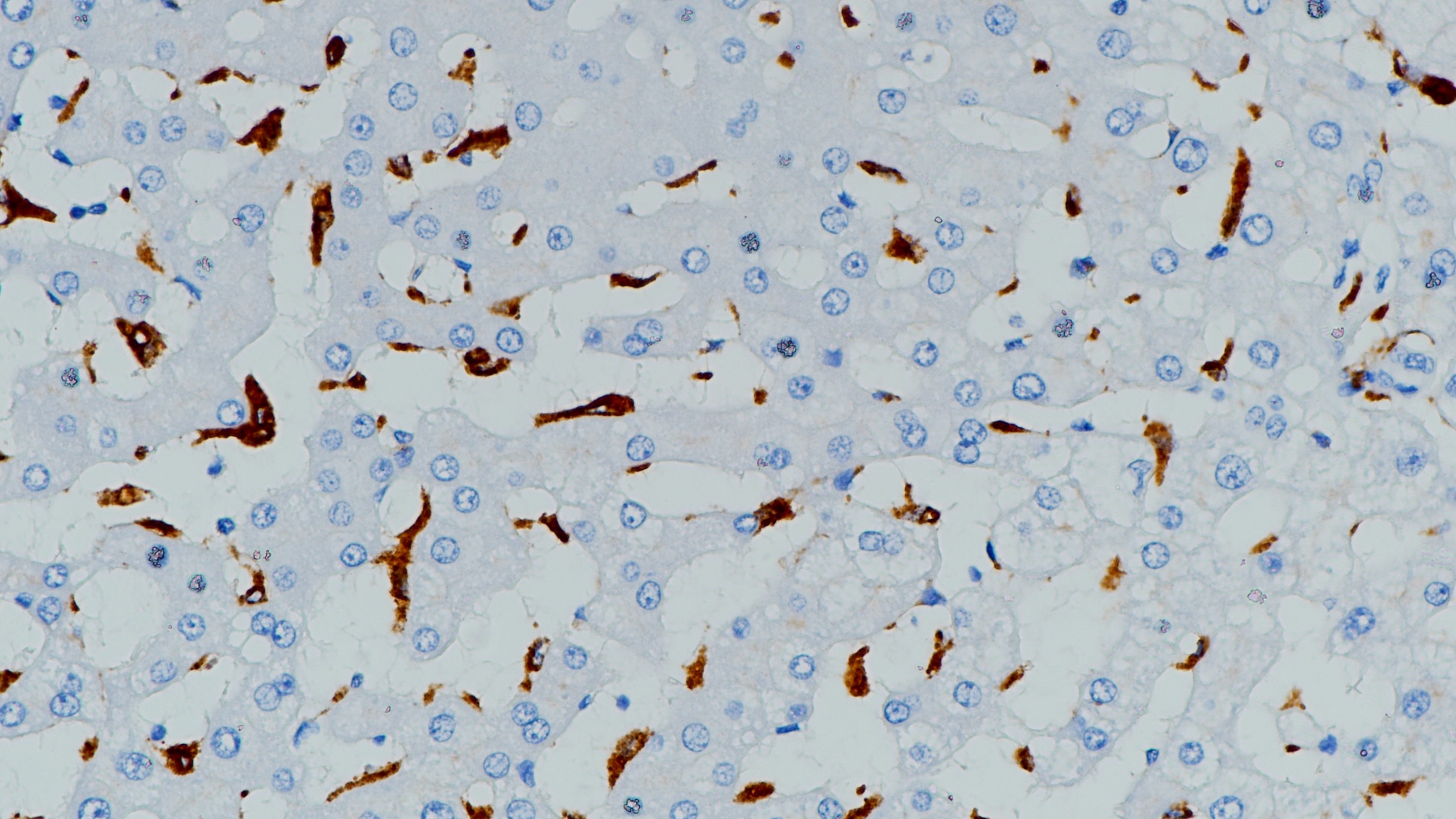 肝CD68(BP6036)染色