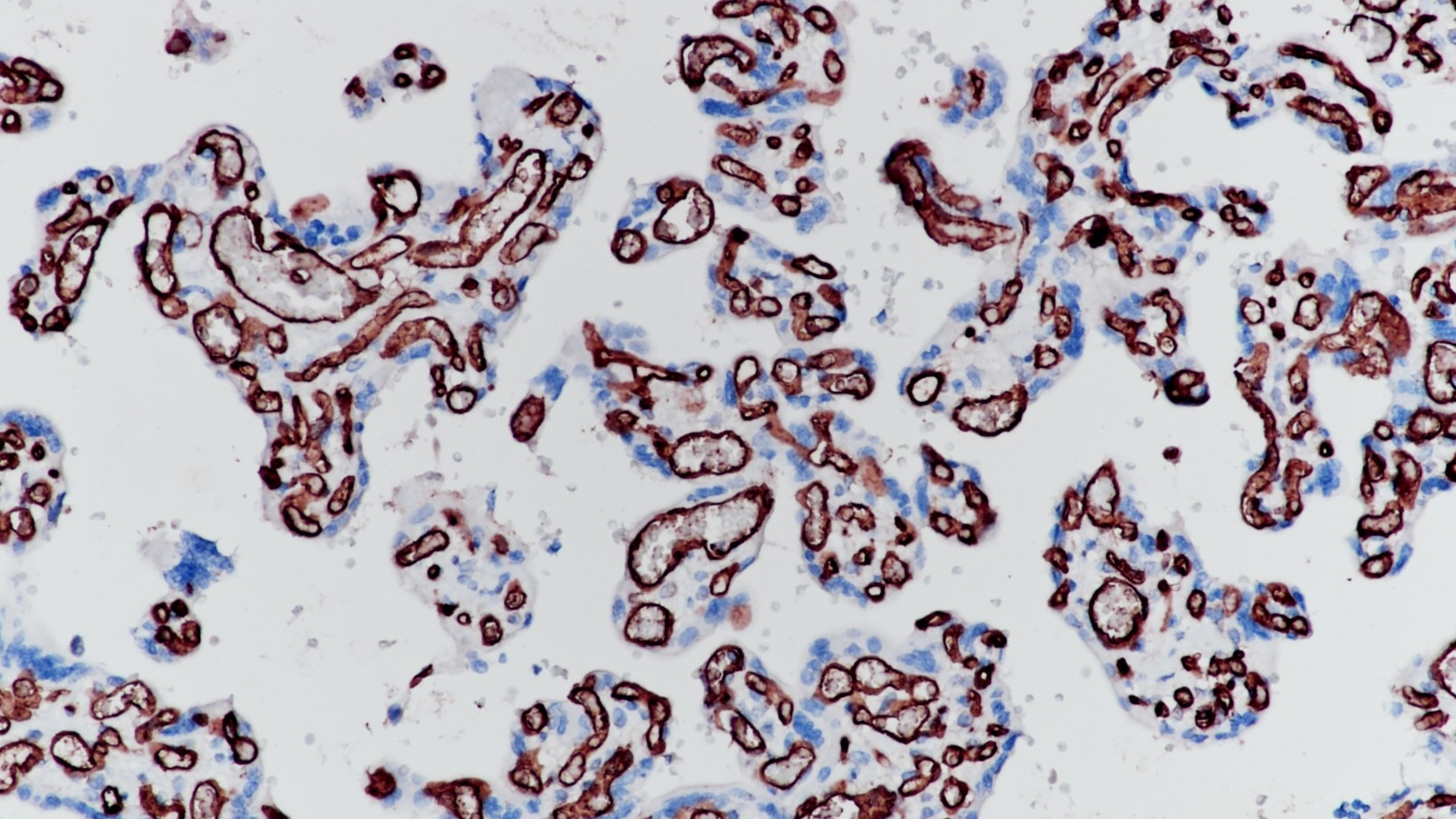 胎盘CD34(BP6047)染色