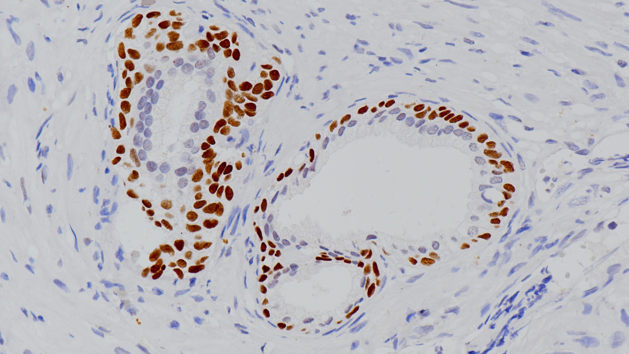 前列腺p63(BP6038)染色