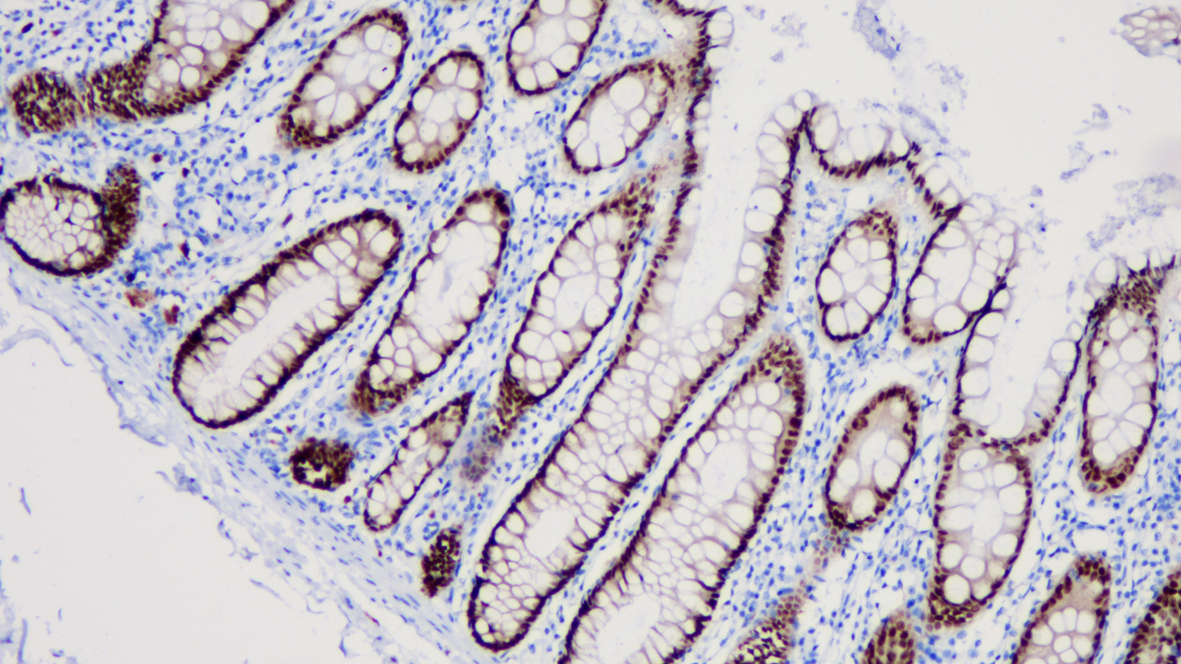 结肠CDX2(BP6023)染色