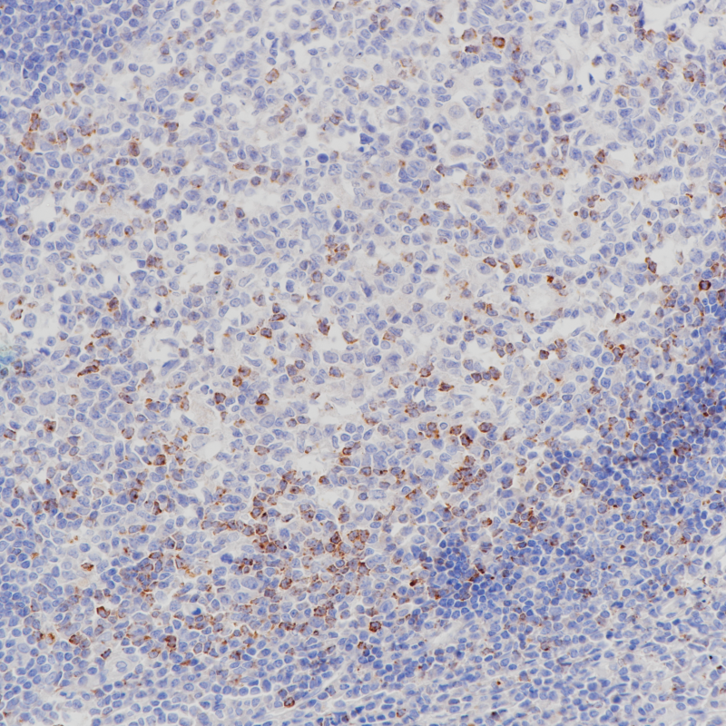 扁桃体CTLA-4(BP6187)染色.png