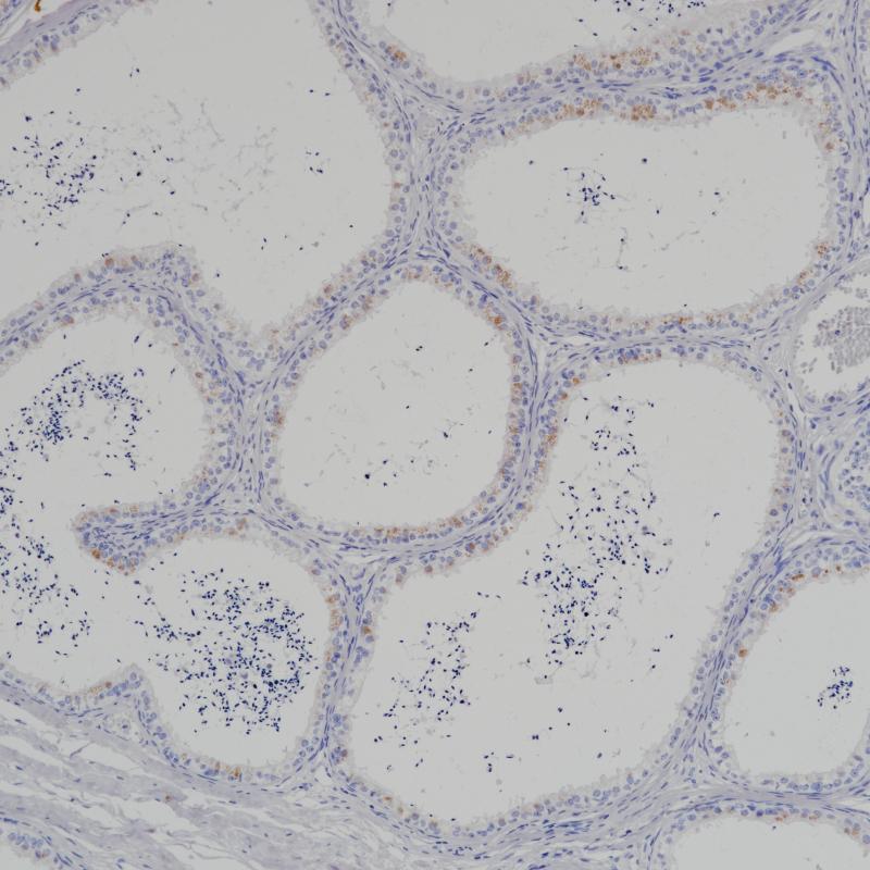 附睾ROS1(BP6215)染色