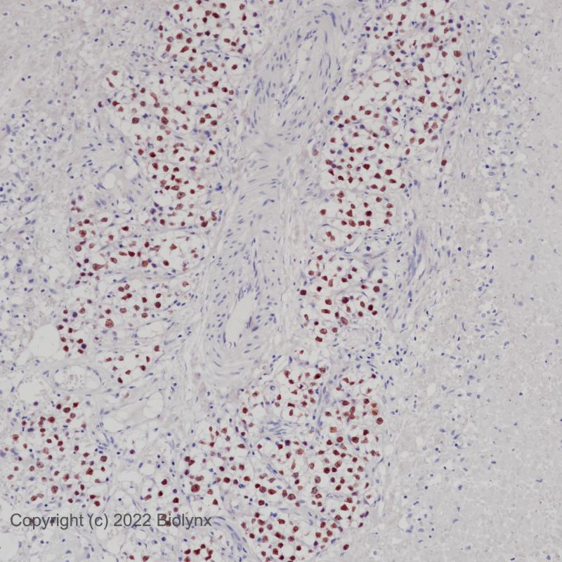 精原细胞瘤SALL4(BP6204)染色