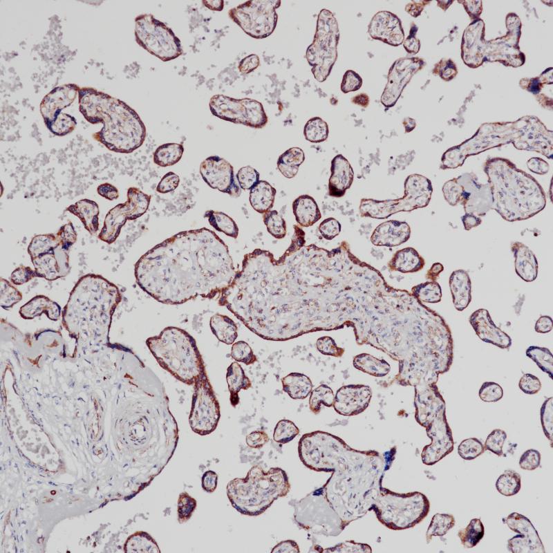 胎盘VEGF(BP6213)染色