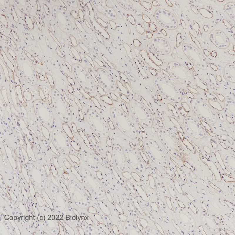 肾COL4A5(BP6206)染色