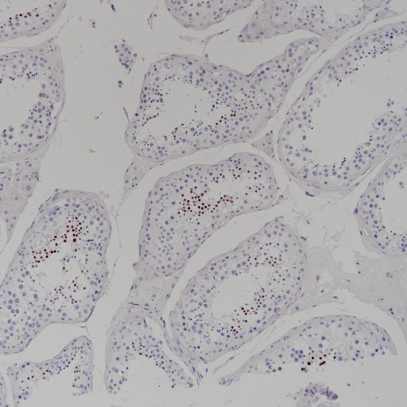 睾丸NUT1(BP6221)染色 (2)