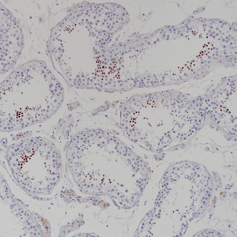 睾丸NUT1(BP6221)染色
