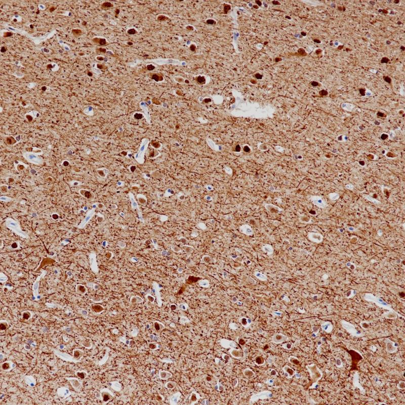 脑Neurofilament(BPM6226)染色(2)