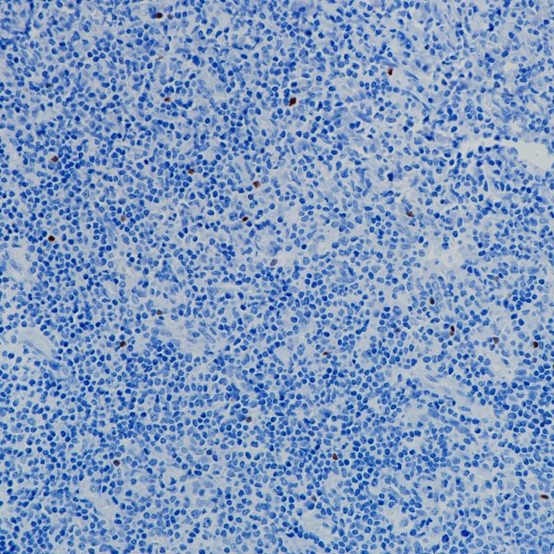 扁桃体ROR gamma T (BP6233)染色