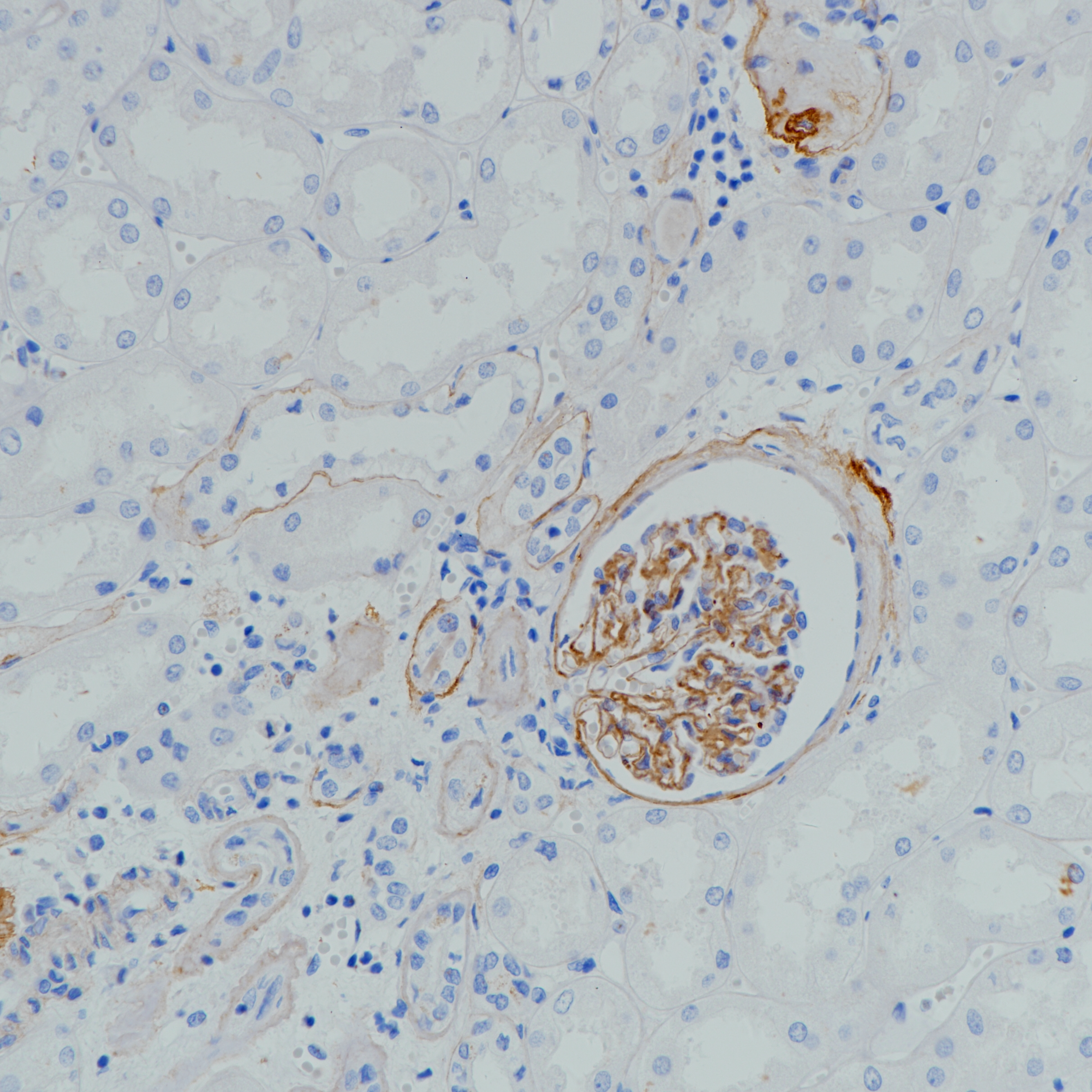 肾Collagen Type IV（BP6206）染色